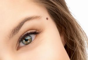 Lý Giải Ý Nghĩa Nốt Ruồi Trên Mặt Nam và Nữ Chi Tiết Nhất