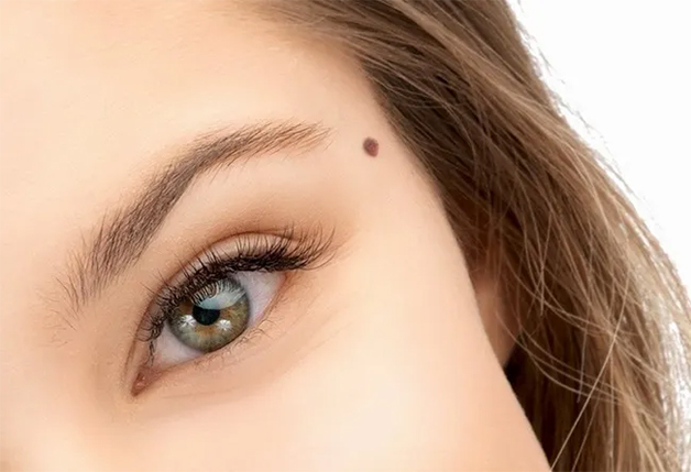 ý nghĩa nốt ruồi trên mặt